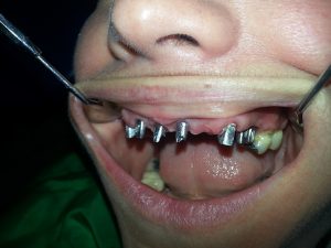 Centro Dental El Alba