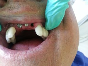 Centro Dental El Alba