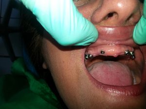 Centro Dental El Alba