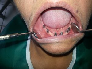 Centro Dental El Alba