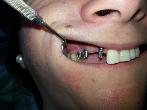 Centro Dental El Alba