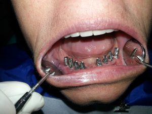 Centro Dental El Alba