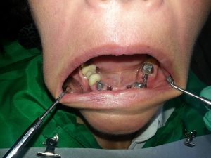 Centro Dental El Alba