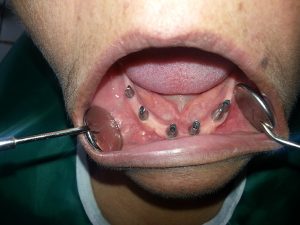 Centro Dental El Alba