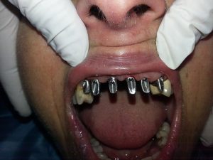 Centro Dental El Alba