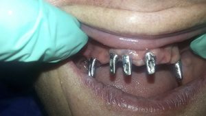 Centro Dental El Alba