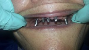 Centro Dental El Alba